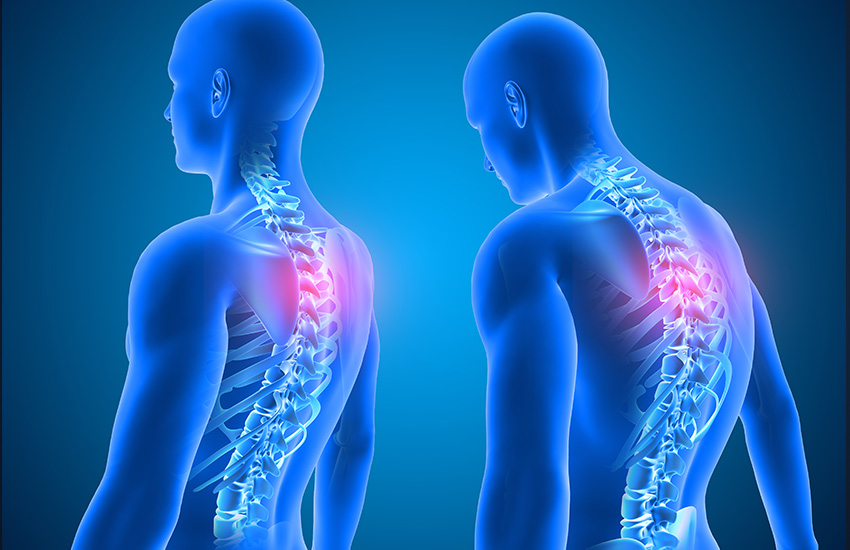 Scoliosis: Understanding and Management