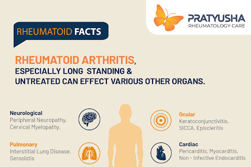 Pratyusha Rheumatology Care | Best Arthritis and Rheumatology Clinic : Best rheumatology doctors in Guntur